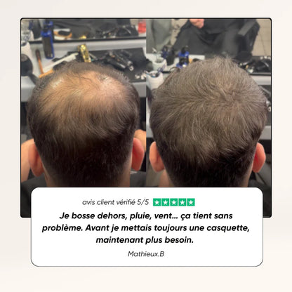 Camouflage capillaire